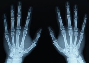 image: X-ray